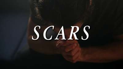 Scars